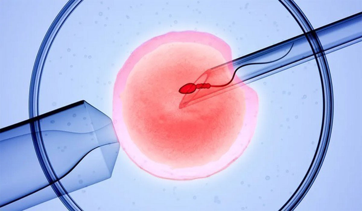 استارت آپ Gameto روش جدید IVF معرفی کرد